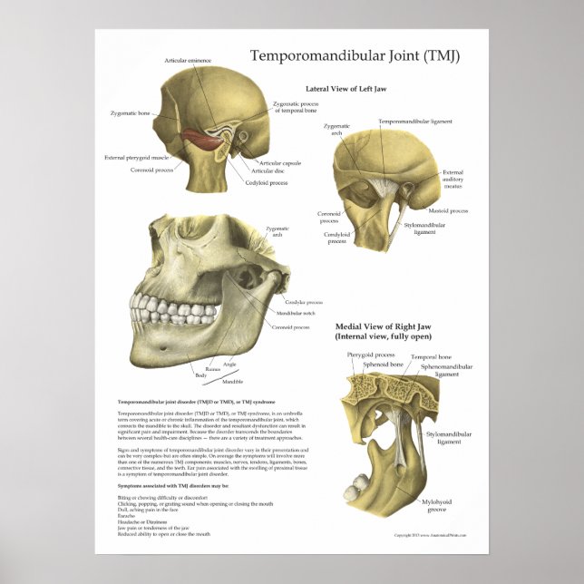 Poster Médicale de l'anatomie du syndrome de l'art (Devant)
