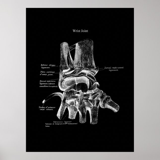 Poster Médicale Poster Poster Orthopédique Décor (Devant)