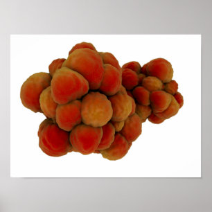Poster Microscopic View Of Tumor 4