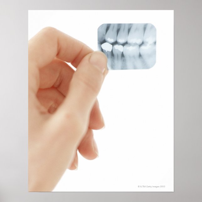 Poster MODÈLE PUBLIÉ. Radiographie dentaire. (Devant)