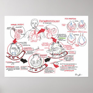 Poster Pathophysiologie de l'emphysème