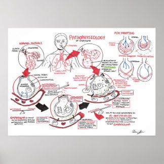 Poster Pathophysiologie de l'emphysème