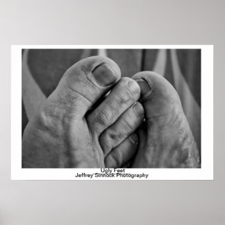 Poster Pieds moches