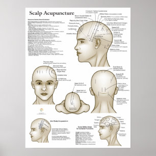 Poster Points d'acupuncture du cuir chevelu