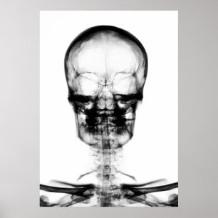 POSTER POSTER/IMPRIMER X RAY VISION SKELETON SKULL - B&W
