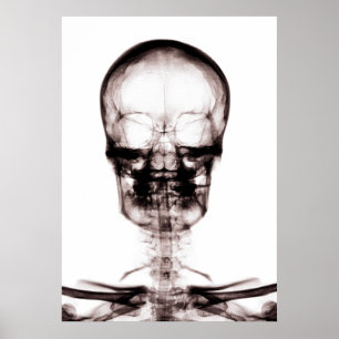 POSTER POSTER/IMPRIMER X RAY VISION SKELETON SKULL ORIG/N