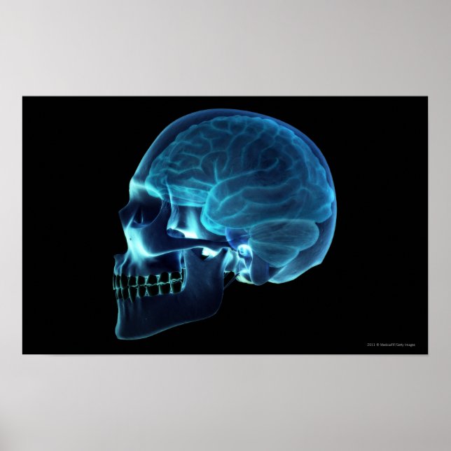 Poster Radiographie du cerveau à l'intérieur d'un crâne (Devant)