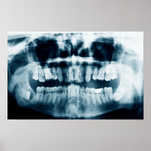 Poster Rayon X des dents