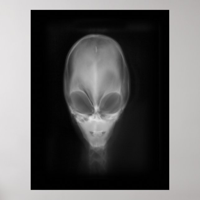 Poster Rayon X du crâne Alien (Devant)