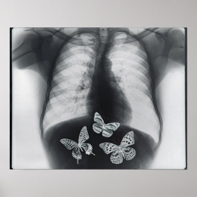 Poster rayons X de papillons dans l'estomac (Devant)