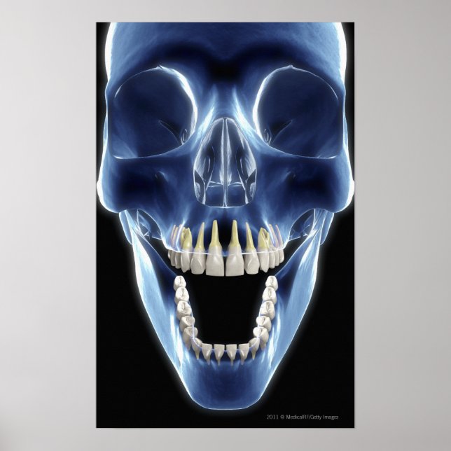 Poster Regarder les dents humaines par rayons X (Devant)