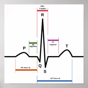 Poster Sinus Rhythm Electrocardiogram ECG Diagram