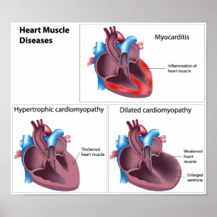 Poster sur les maladies du coeur