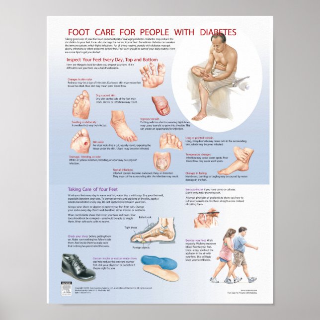 Poster sur les soins du pied du diabète - Carte ré (Devant)