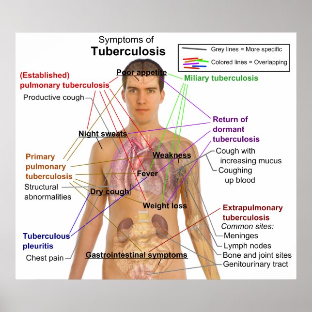 Poster Symptôme de la tuberculose chez l'homme (Devant)