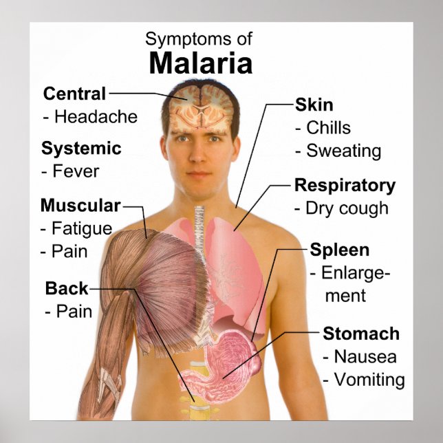 Poster Symptômes Graphique de la maladie du paludisme cau (Devant)