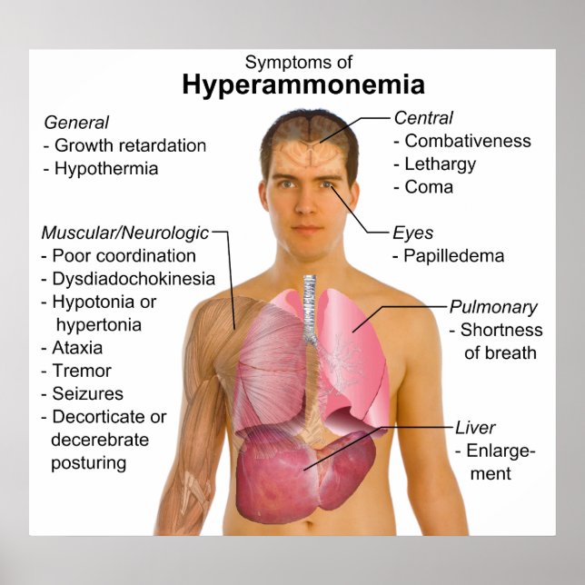 Poster Symptômes Graphique des maladies métaboliques Hype (Devant)
