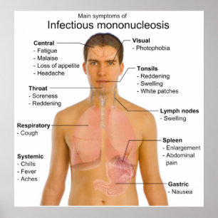 Poster Symptômes principaux de la mononucléose infectieus