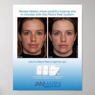 Poster Système Peel Marini 8x10"
