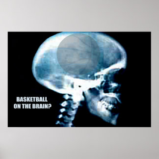 Poster Tête de basket-ball (rayons X)