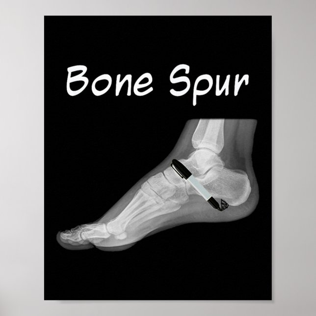 Poster Trump Bone Spur Enk Pen Drôle Anti Trump (Devant)