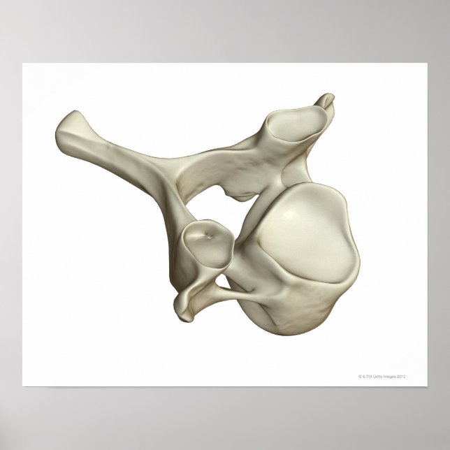 Poster Vertébra cervical (Devant)