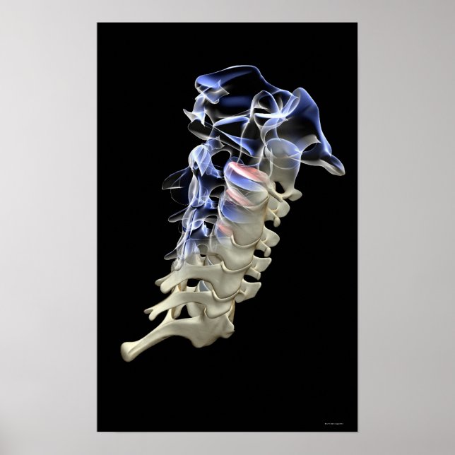 Poster Vertèbre cervicale 4 (Devant)
