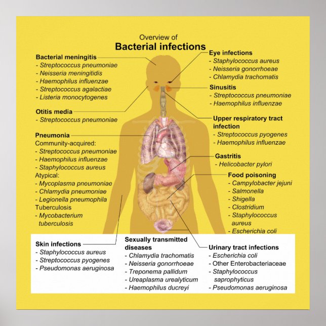 Poster Vue d'ensemble des infections bactériennes (Devant)