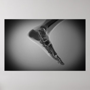 Poster Vue En Rayon X Du Pied Humain 4