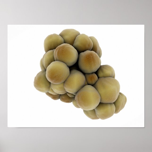 Poster Vue Microscopique De La Tumeur 5 (Devant)