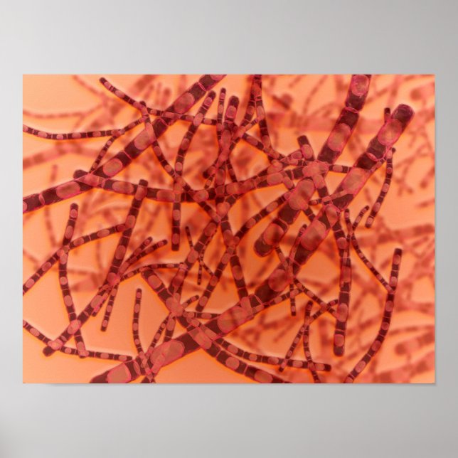 Poster Vue Microscopique De L'Anthrax 3 (Devant)