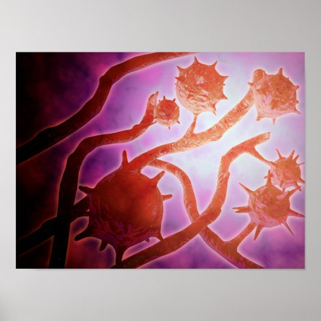 Poster Vue Microscopique De L'Histoplasmose (Devant)