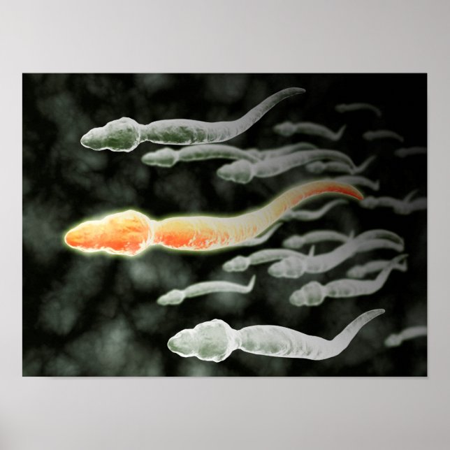 Poster Vue Microscopique De Sperm Voyageant (Devant)