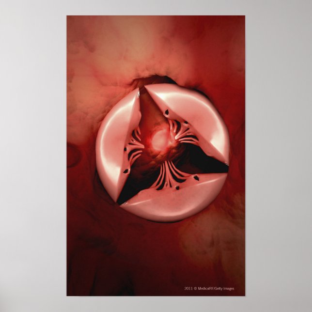 Poster Vue rapprochée de la valve tricuspide dans le coeu (Devant)