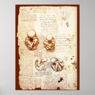 Poster Vues d'un fœtus dans l'utérus, Ob-Gyn Médical