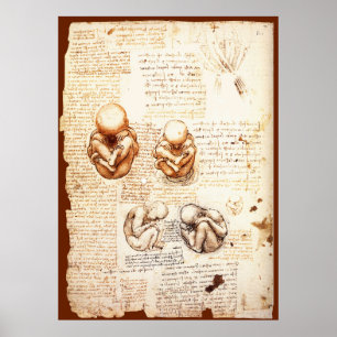 Poster Vues d'un foetus dans l'utérus, Ob-Gyn Médicale