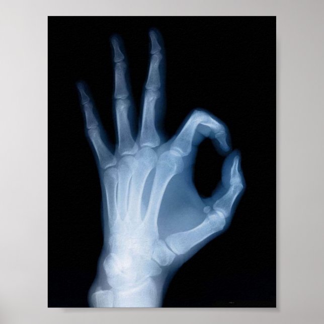 POSTER X-RAY A-OK (Devant)