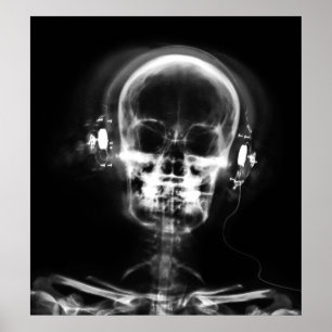 POSTER- X-RAY MUSIC SKELETON BLACK GREY B&W POSTER