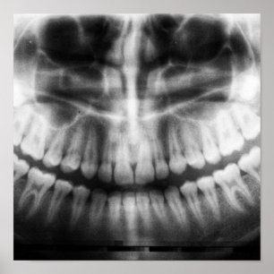 Poster X-Ray Teeth Mouth Smile Black and White