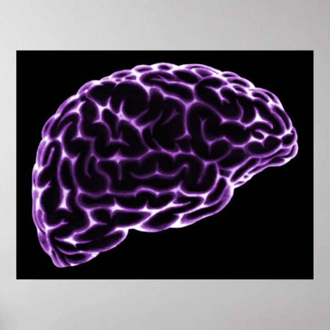 POSTER XRAY CÔTÉ CERVEAU VUE PURPLE (Devant)