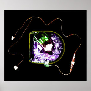 POSTER XRAY DISCMAN