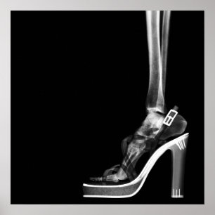 POSTER XRAY HIGEL LADY SKELETON FOOT B&W
