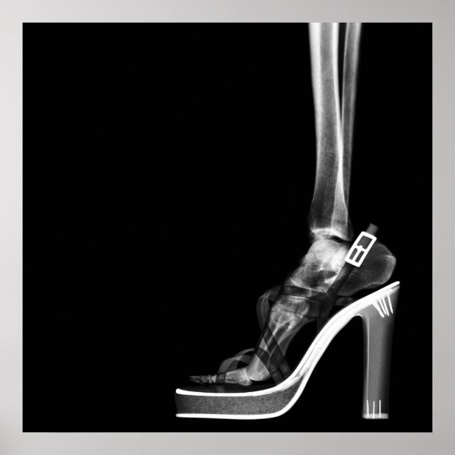 POSTER XRAY HIGEL LADY SKELETON FOOT B&W (Devant)