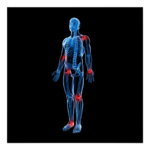 Poster Xray humain