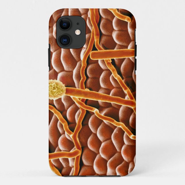 Powdery Mildew Fungus on Poinsettia Case-Mate iPhone Case (Back)