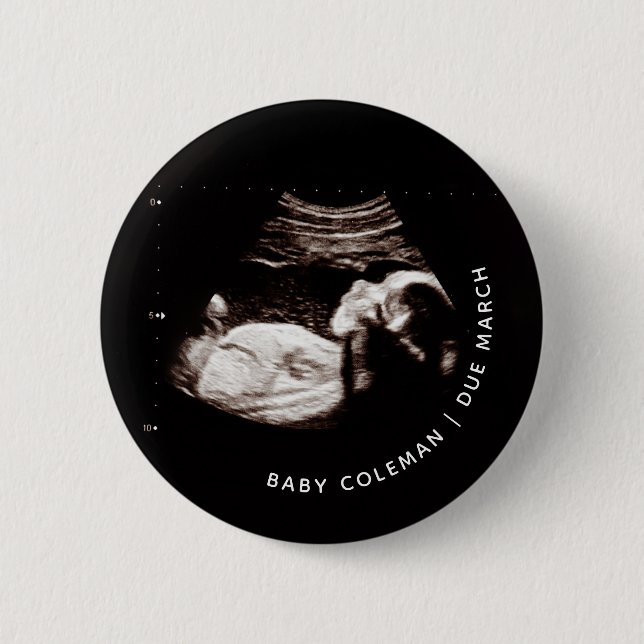 Pregnancy Announcement Baby Sonogram Photo 2 Inch Round Button (Front)