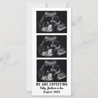 Pregnancy Announcement Card With Ultradound Photos