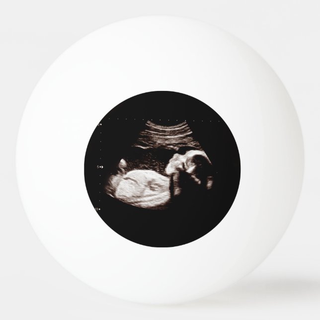 Pregnancy Announcement Sonogram Ultrasound Photo Ping Pong Ball (Front)
