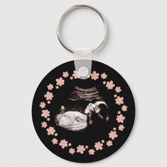 Pregnancy Baby Glitter Sonogram Ultrasound Photo Keychain (Front)