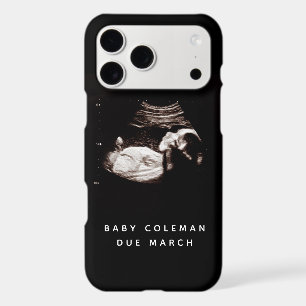 Pregnancy Baby Sonogram Ultrasound Photo